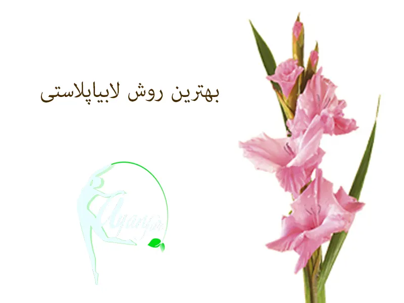 بهترین روش لابیاپلاستی